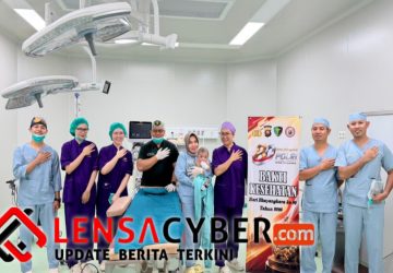 Sambut Hari Bhayangkara ke-80, Polda Kalbar Gelar Bakti Sosial dan Operasi Bibir Sumbing Gratis